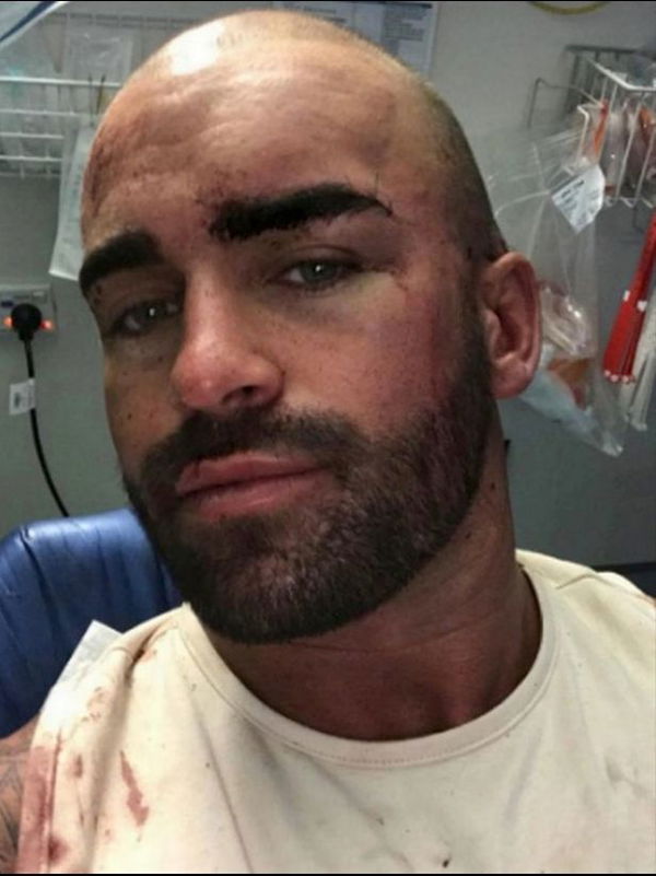 1_THIS-is-the-horror-moment-an-OnlyFans-bodybuilder-was-battered-with-a-metal-stool-in-a-bar-brawl-tha