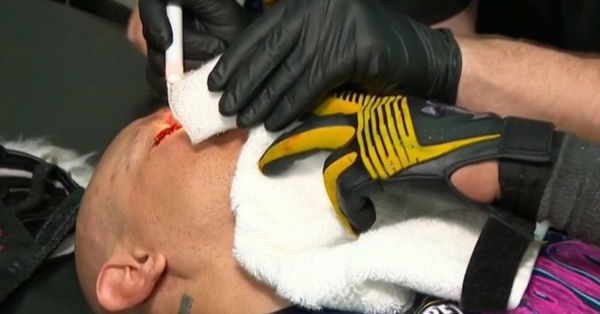 rey-mysterio-blind-wwe-monday-night-raw-1220087-1280&#215;0