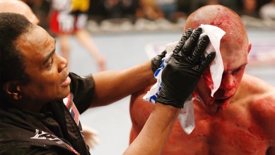 ufc