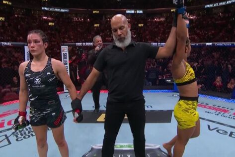 Calls Mount for Alexa Grasso’s Retirement as Natalia Silva Leaves Former Champ With Nasty Cut at UFC 315