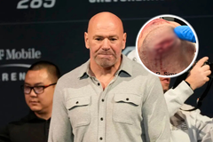 Dana White Ricky Simon