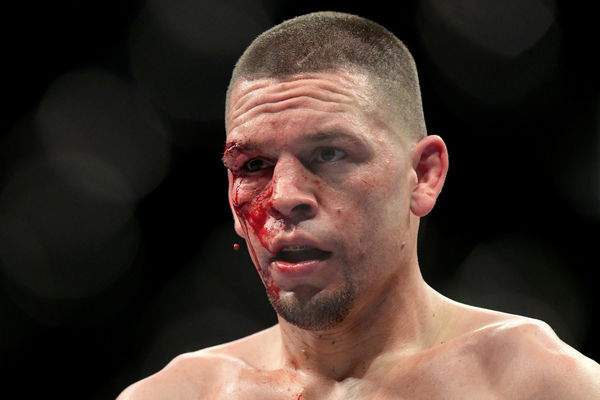 I M In The Title Fight Nate Diaz Blood Hot Ready For Ufc 263 Essentiallysports