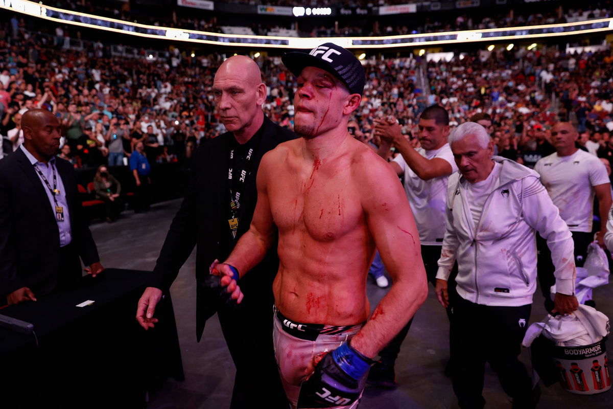 Nate Diaz