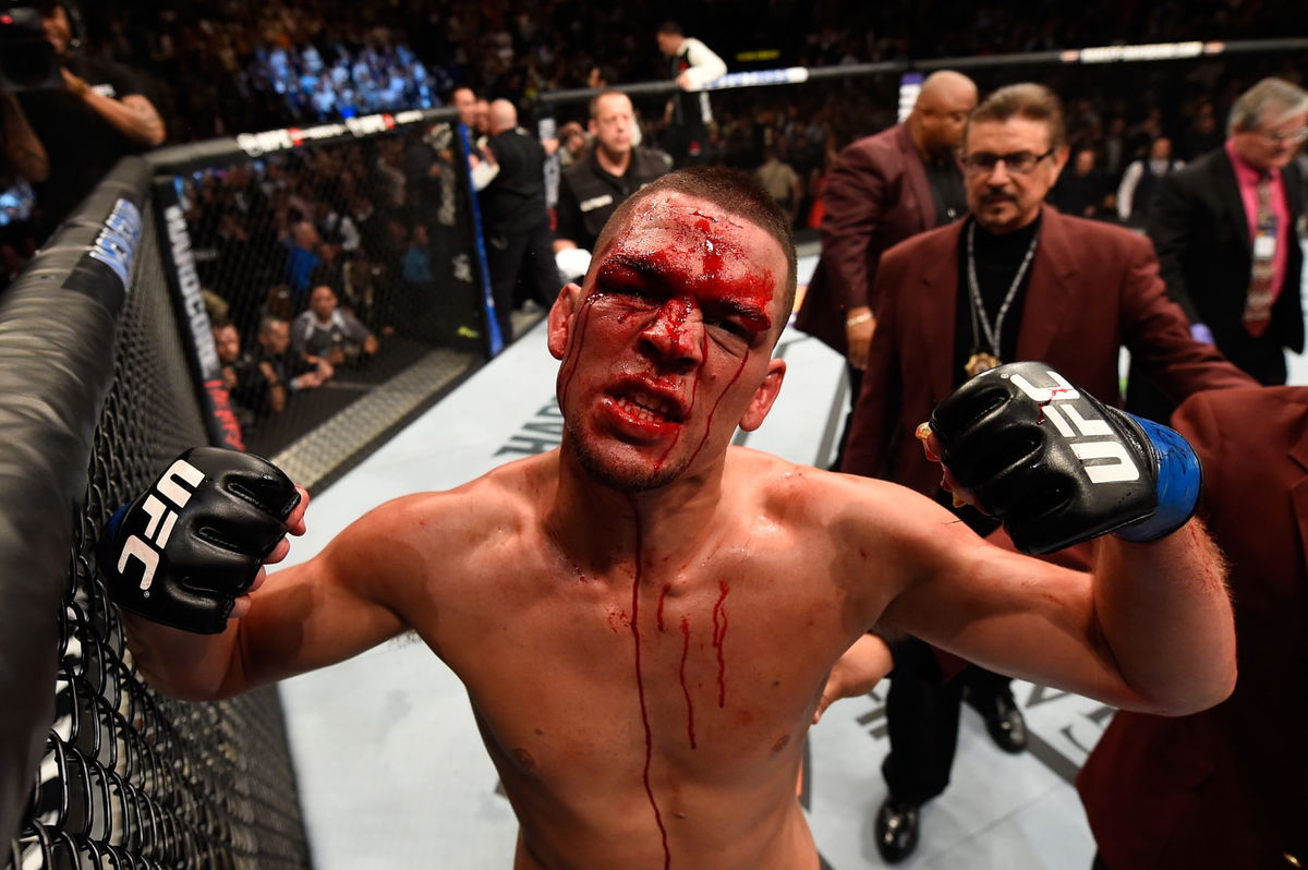 Nate Diaz