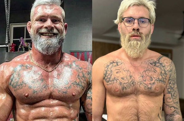 Athletes Before and After Steroid Use