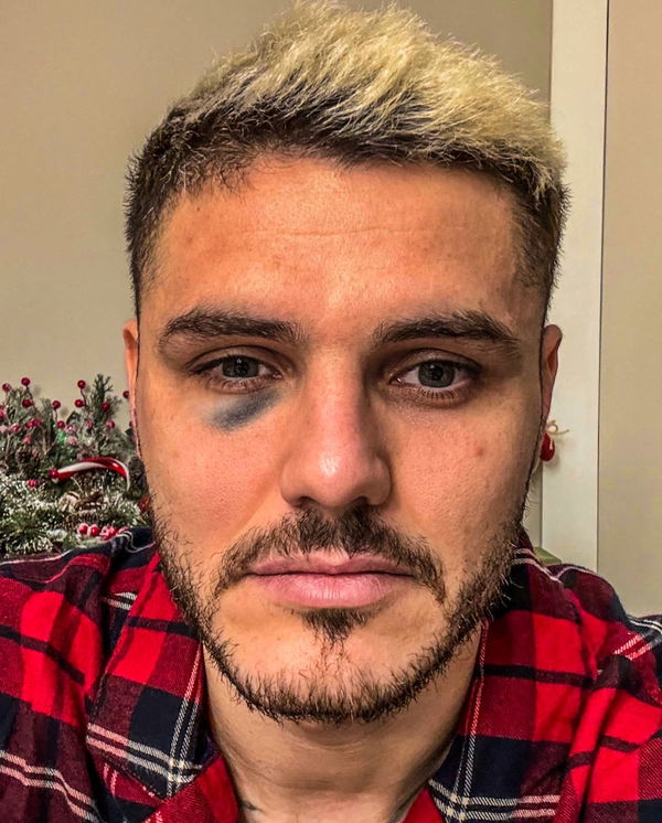 Mauro Icardi