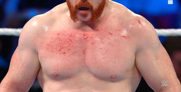 Sheamus