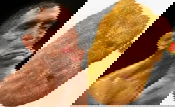 feature-image