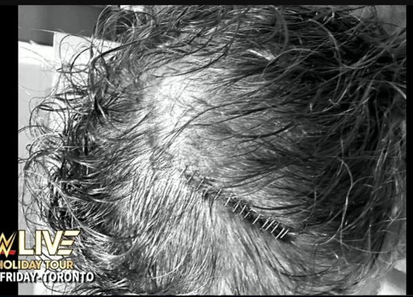 feature-image