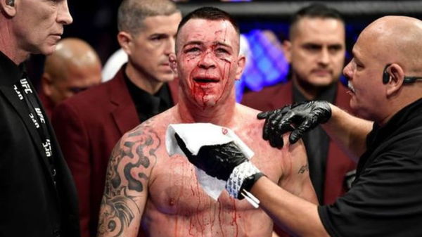 Colby-Covington-broken-jaw