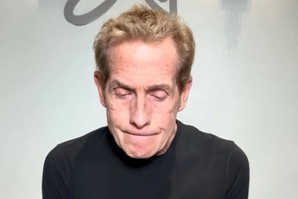 Skip Bayless