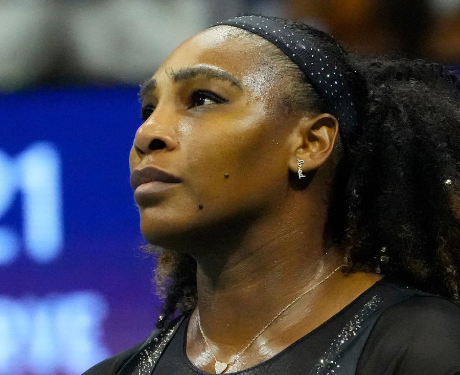 Infamous for Nasty Comment on Serena Williams’ Daughter, Romanian