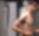 Image for “People Used to Call Me Twig Arms”: Boy Bullied for His Skinny Arms Turns Them
Into “Tree Trunks” With Relentless Hardwork for 5 Years